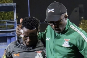 阿媒：赞比亚中场普林斯·蒙巴训练中受伤，可能赶不上出战阿根廷