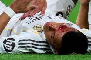 龙赛罗晒姆巴佩流血照:这就是西班牙裁判,内格雷拉仍在操控一切